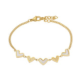 iXXXi Armband Lover - iXXXi Jewelry