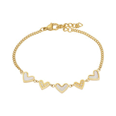 iXXXi Armband Lover - iXXXi Jewelry