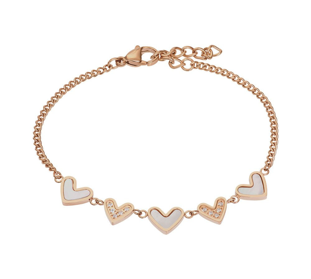 iXXXi Armband Lover - iXXXi Jewelry